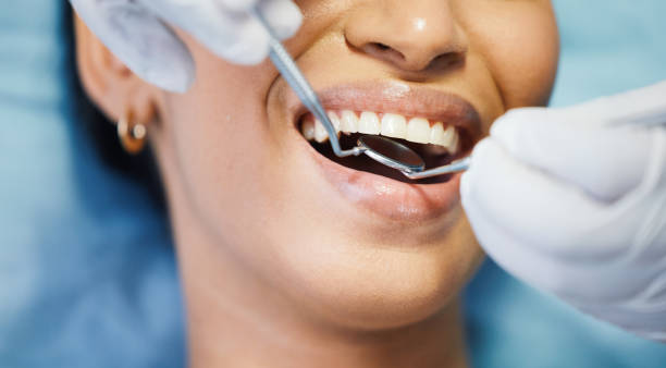 Best Emergency Root Canal Treatment in Franklin, NH