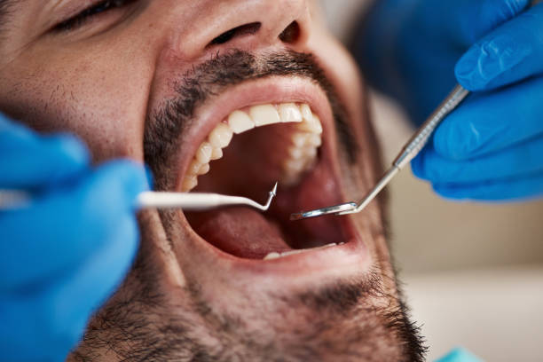 Best Emergency Tooth Extraction in Franklin, NH