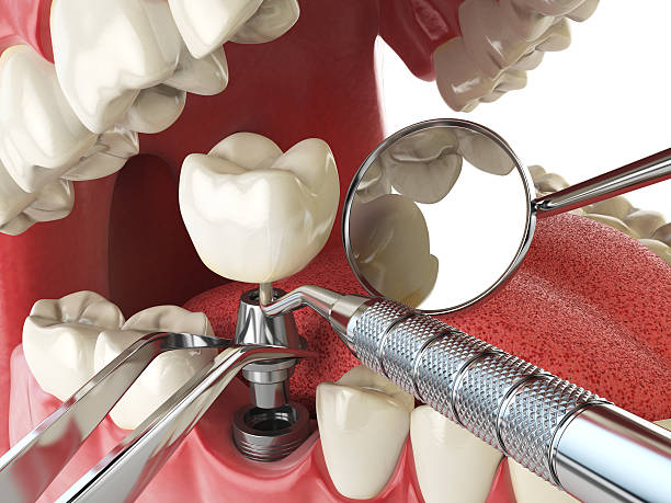 Best Emergency Dental Surgery in Franklin, NH